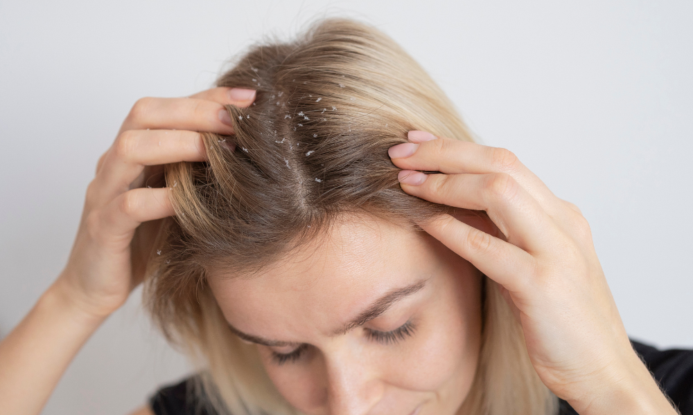 7 Erros Que Impedem Seu Cabelo de Crescer 6