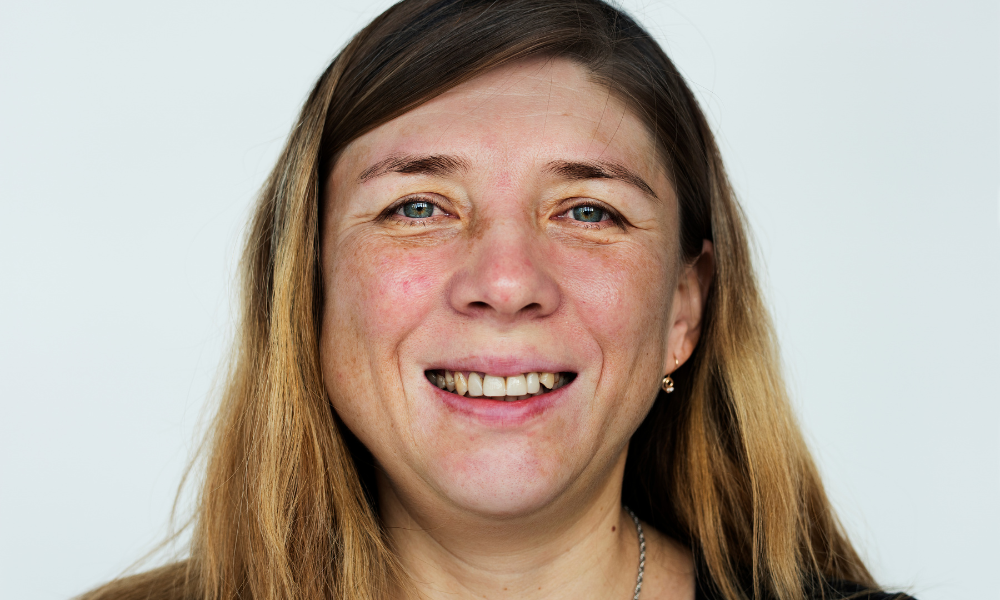 Niacinamida ou Vitamina C Qual e Melhor Para Sua Pele 3